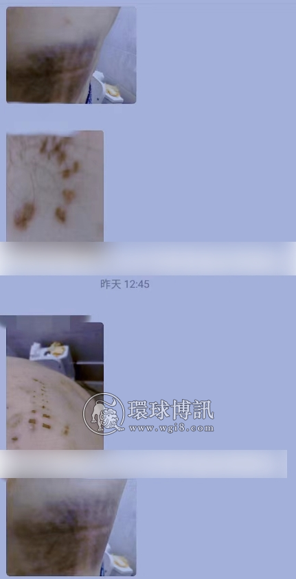 打工人在西港被强行卖入诈骗园区，遍体鳞伤命悬一线之际向老乡群发出求救？