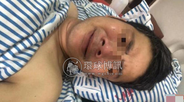 江西小伙因“百万年薪”被骗到缅甸从事电信诈骗，逃跑时遭殴打至手腿粉碎性骨折