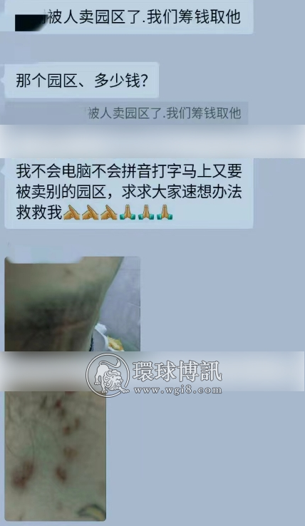 打工人在西港被强行卖入诈骗园区，遍体鳞伤命悬一线之际向老乡群发出求救？