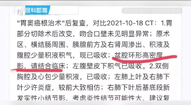 直径8厘米器械遗患者腹中3个月？医院：医疗行为有不确定性