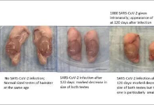 新冠后遗症最新研究:或致性欲减退生育能力降低